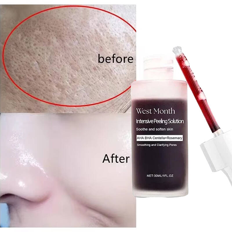 Tranexamic Acid Serum - Terasa Seperti Sutra, Terlihat Seperti Filter.
