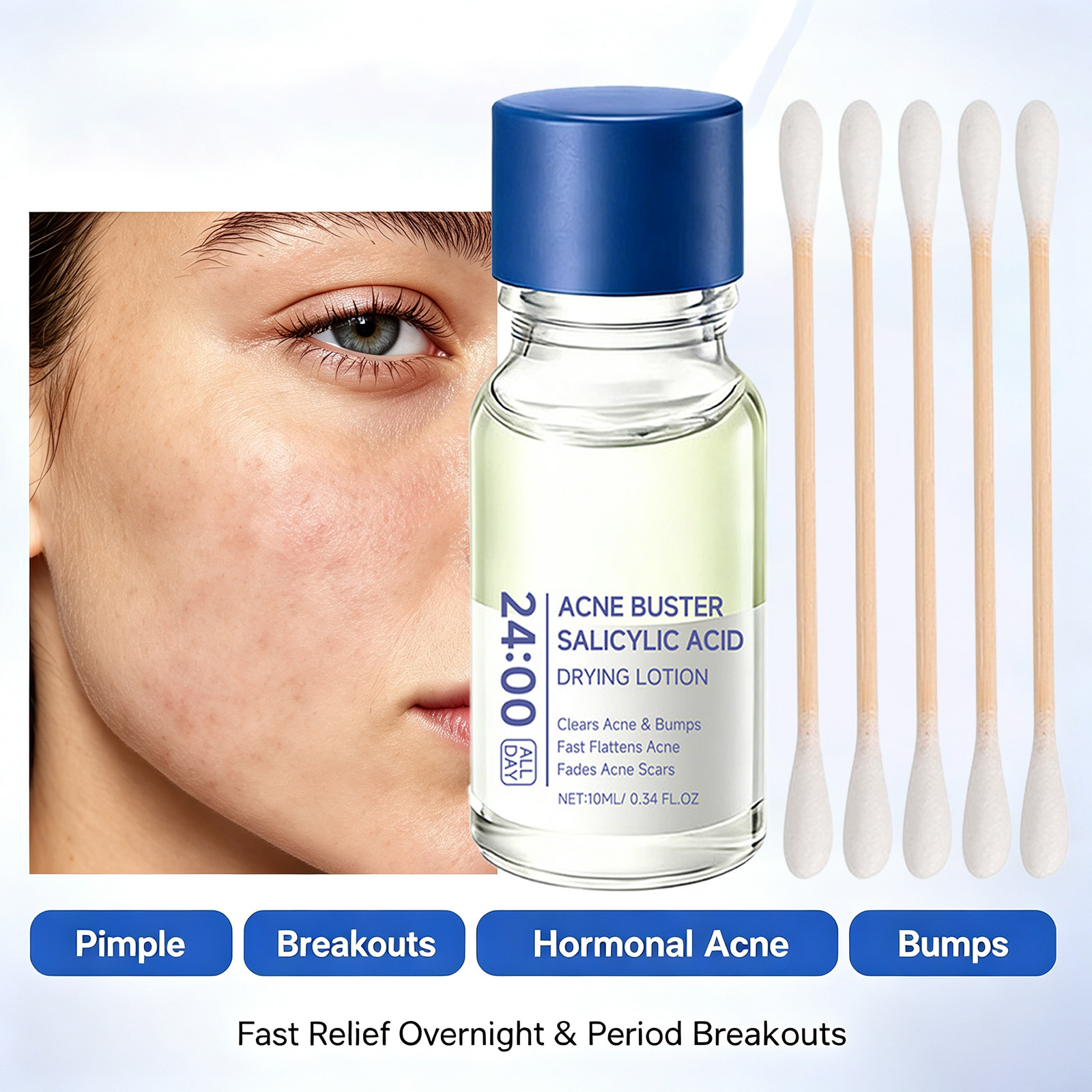 Tranexamic Acid Serum - Serum Perawatan Jerawat Asam Salisilat Penghilang