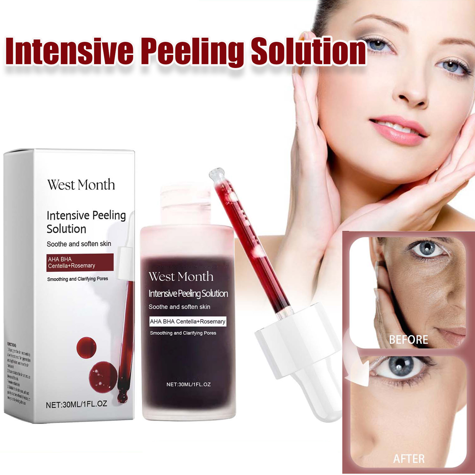 Tranexamic Acid Serum - Serum Wajah Pengelupas Anti Jerawat Mencerahkan