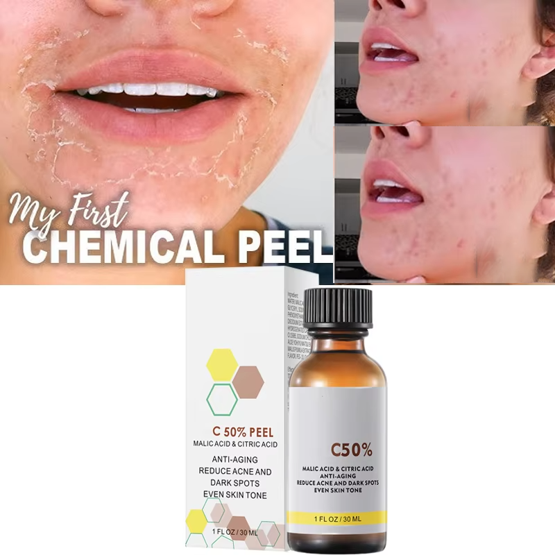 Tranexamic Acid Serum - Dengan Asam Malat dan Asam Sitrat