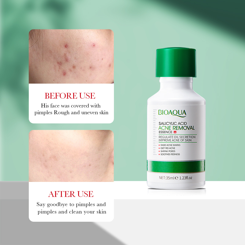 35Ml BIOAOUA Asam Salisilat Es - Tranexamic Acid Serum ulasan dan harga