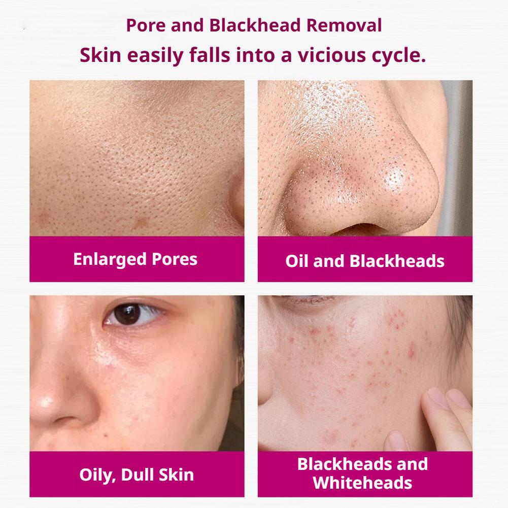 Serum Asam Salisilat Mengecilk - Tranexamic Acid Serum ulasan dan harga