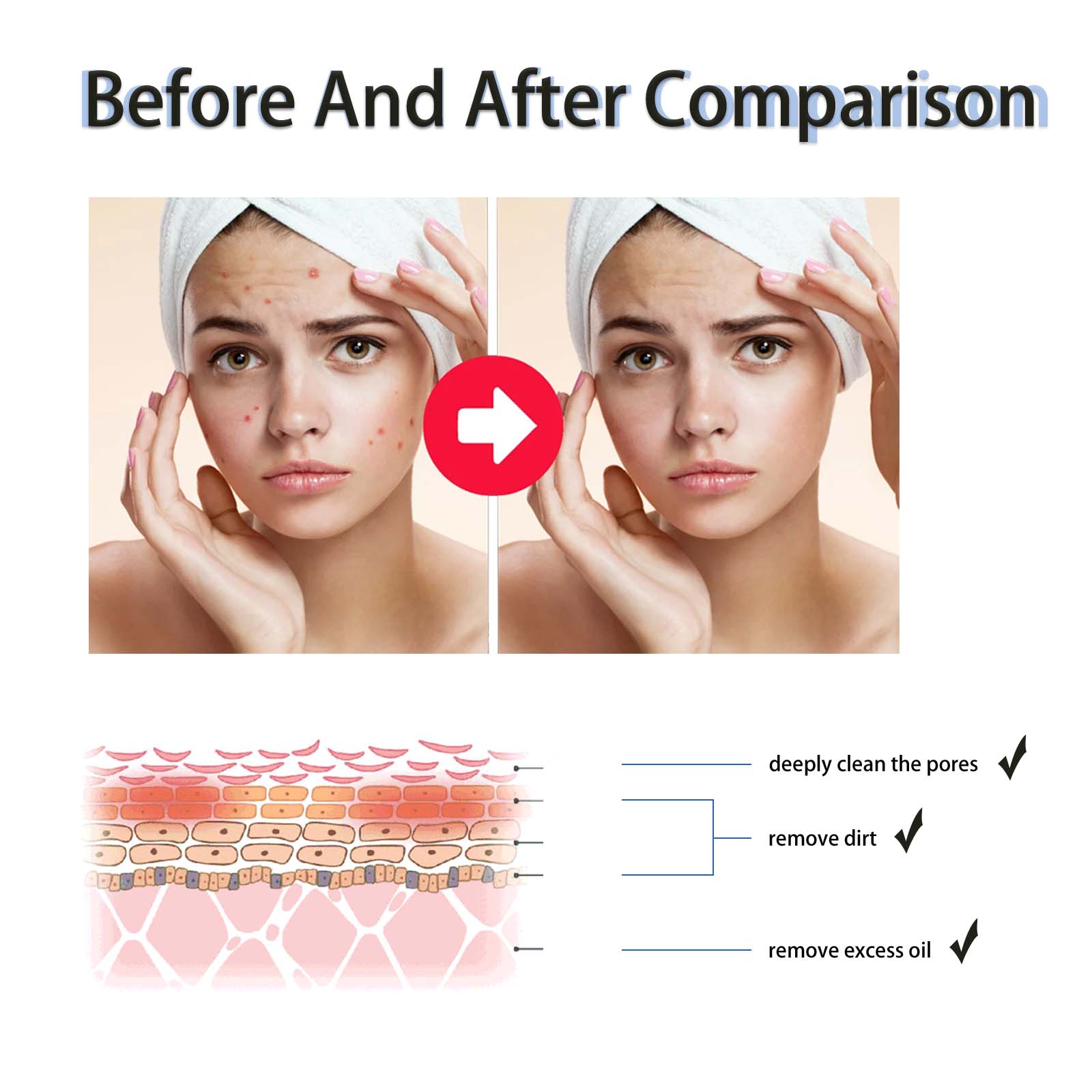 Serum Pengencang Pori-pori den - Tranexamic Acid Serum ulasan dan harga