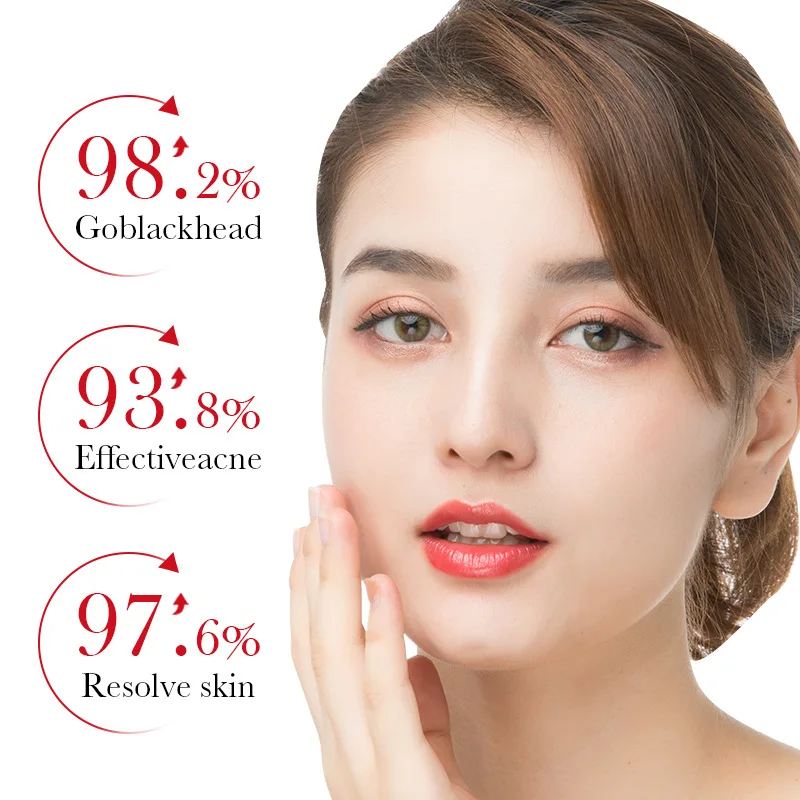 BIOAQUA Serum penghilang jeraw - Tranexamic Acid Serum ulasan dan harga