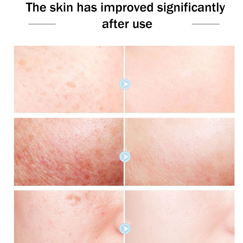 Krim Wajah Merek Queen Asli PZ - Skincare Queen ulasan dan harga