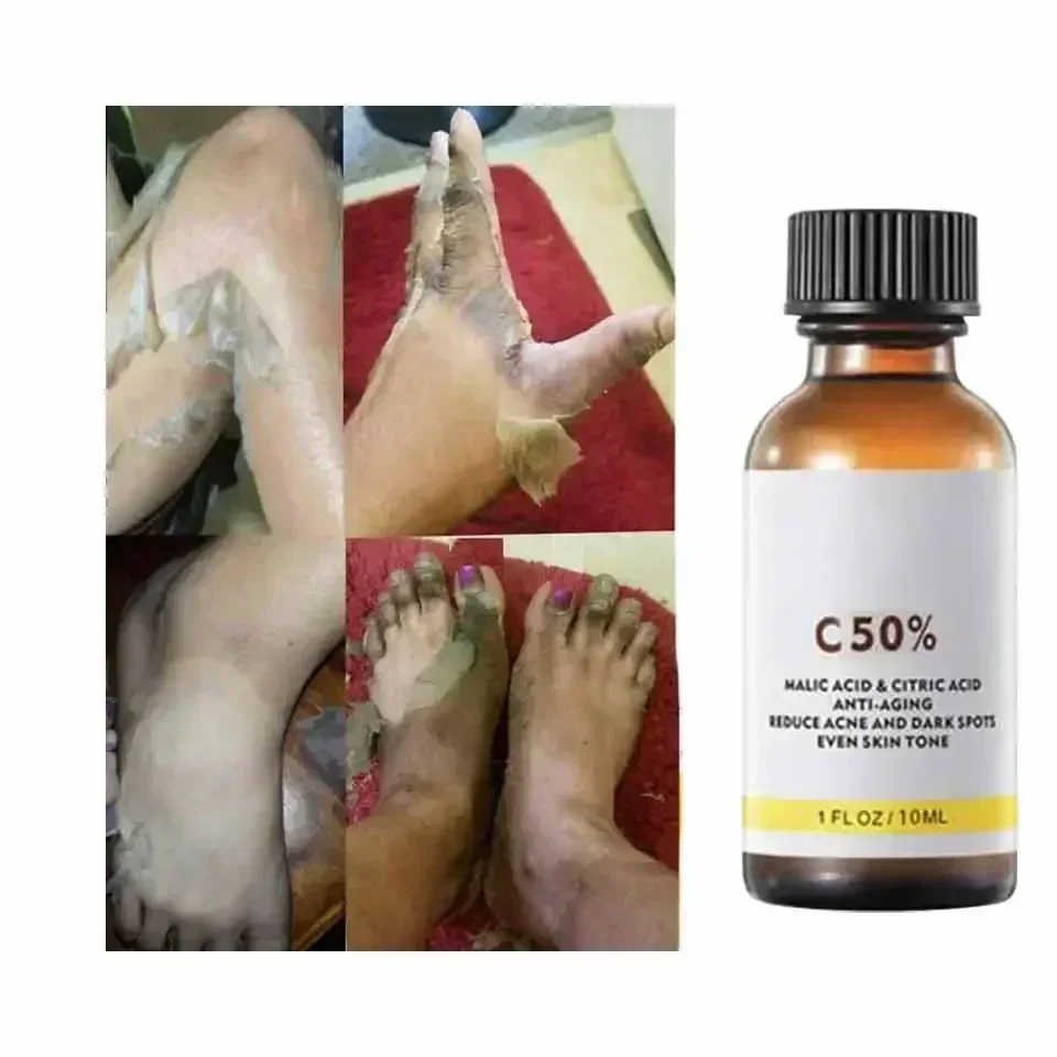 Dengan Asam Malat dan Asam Sit - Tranexamic Acid Serum ulasan dan harga